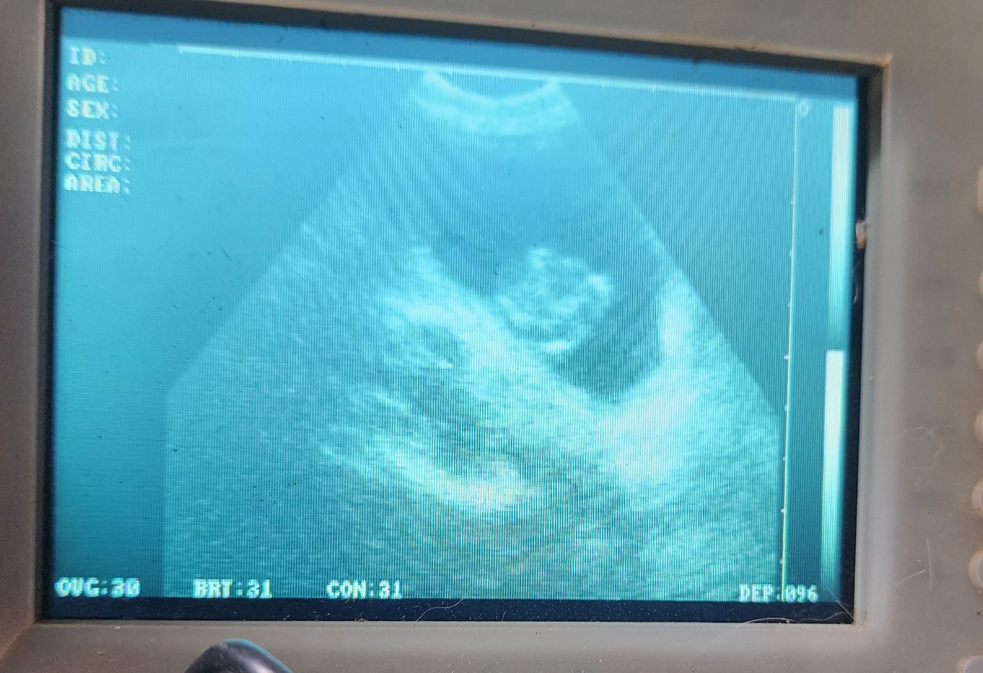 Naissance début Octobre